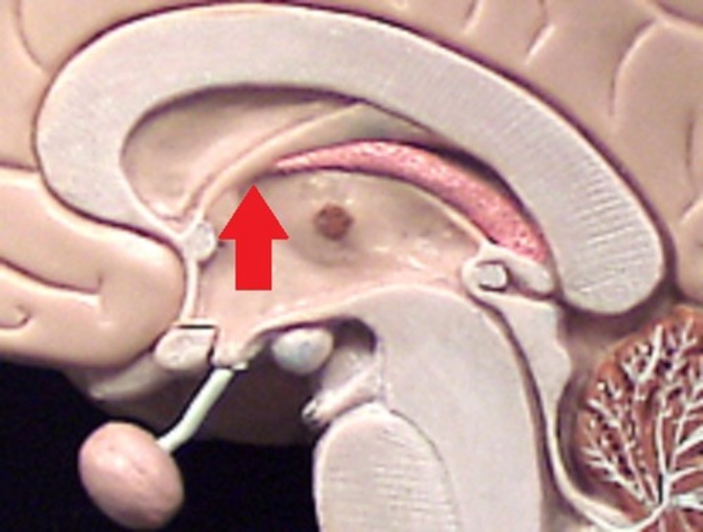 <p>connects lateral ventricles to third ventricle</p>