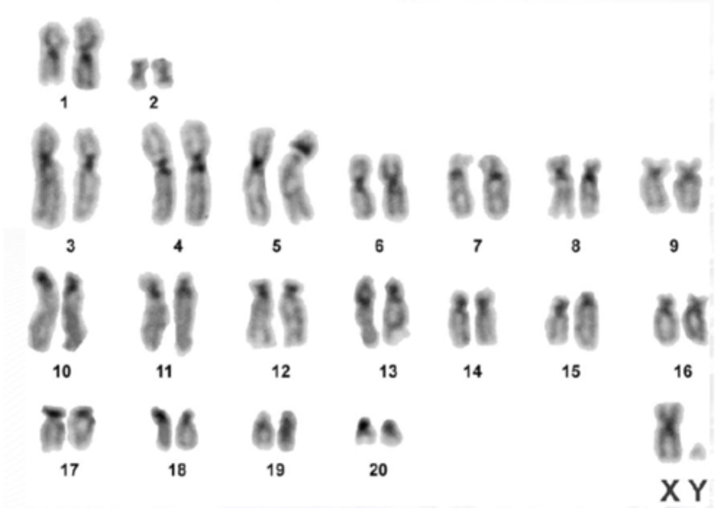 <p>Dark-staining areas are only the centromeres.</p><p>There is denaturation of the DNA.</p><p>&gt; Destroys the hydrogen bonds</p><p>&gt; The denatured parts are lightly staining.</p><p>Tendency of repetitive DNA (like centromere, if we denature it, it can naturally renature</p><p>We use a brightfield microscope</p>