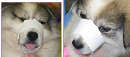 <p>Treatment for <span style="background-color: transparent;"><span>Fractures of the Mandible and Maxilla</span></span></p>