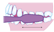 <p><span><strong>• Teeth are edge to edge</strong></span></p><p><span><strong>• Brush maintains a 90-degree angle to long axis of tooth</strong></span></p><p><span><strong>• Horizontal strokes</strong></span></p><p><span><strong>• Can cause toothbrush abrasion</strong></span></p>