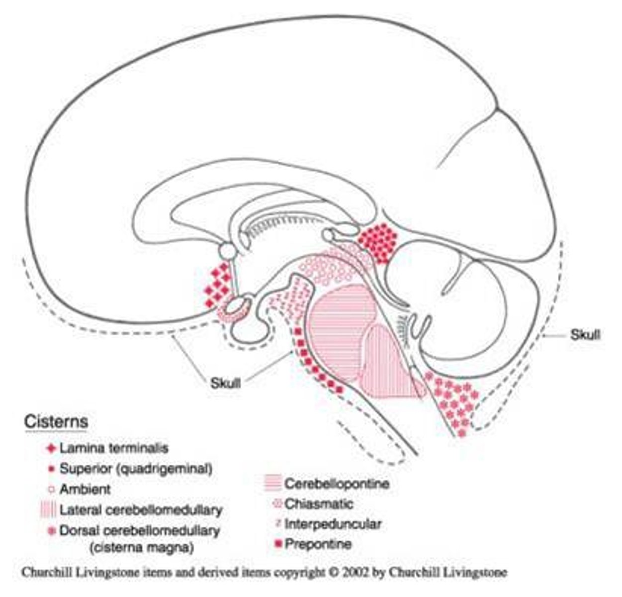 <p>The supratentorial and infratentorial regions of the subarachnoid space are connected by the narrow gap between the midbrain and the border of the tentorial incisure. This region can get obstructed, leading to an abnormal ventricular dilation.</p><p>There are several places where the subarachnoid space is normally dilated. These expanded regions of the subarachnoid space serve as reservoirs of CSF and are known as what?</p>