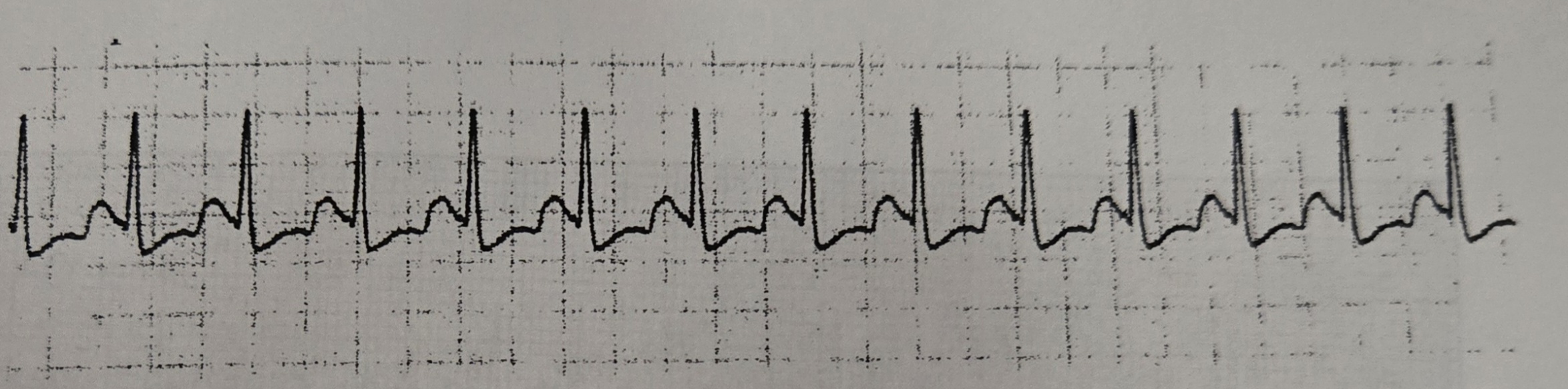 <p>What Rhythm is this?</p>