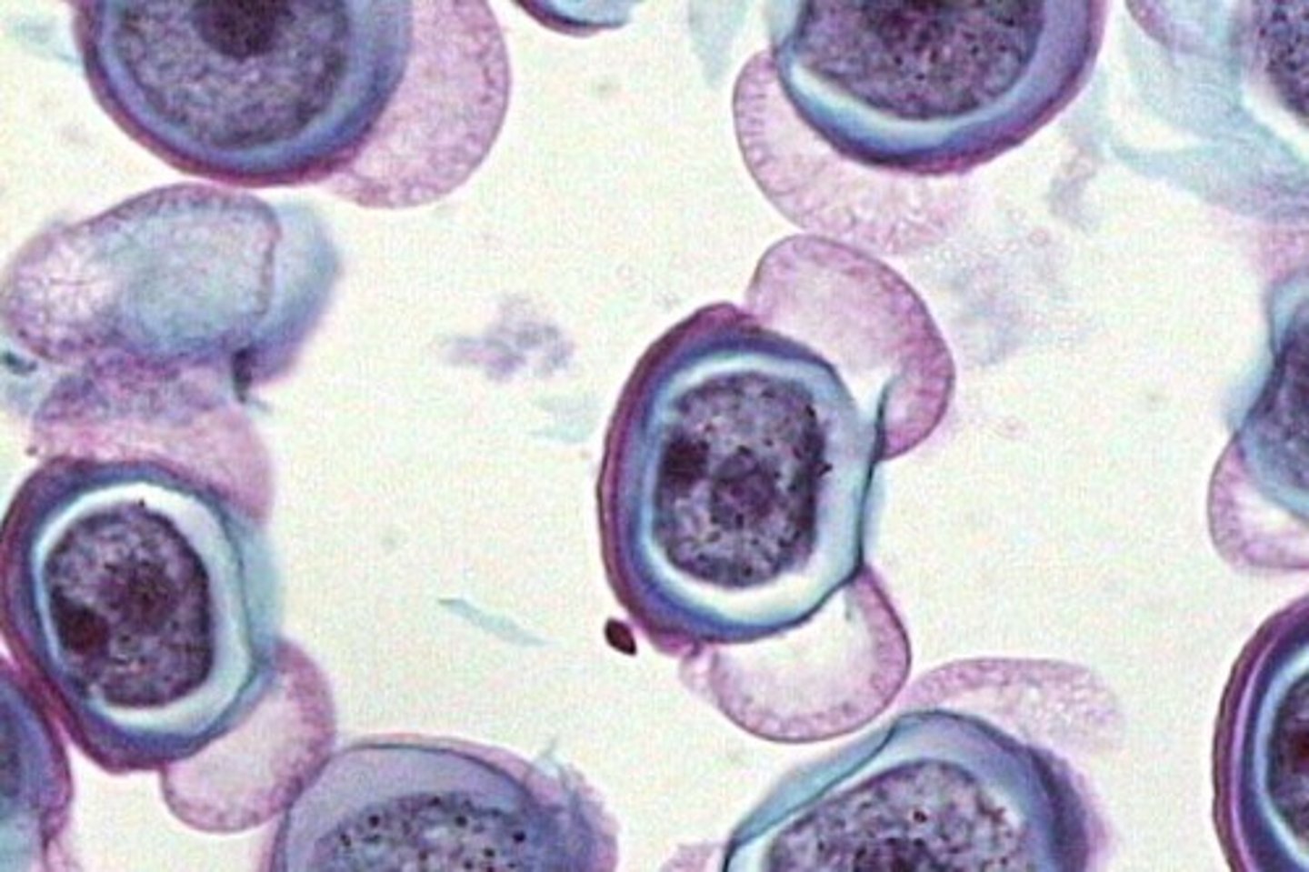 <p>male gametophyte; contains 2 prothallial cells, 1 generative cell, 1 tube cell</p>