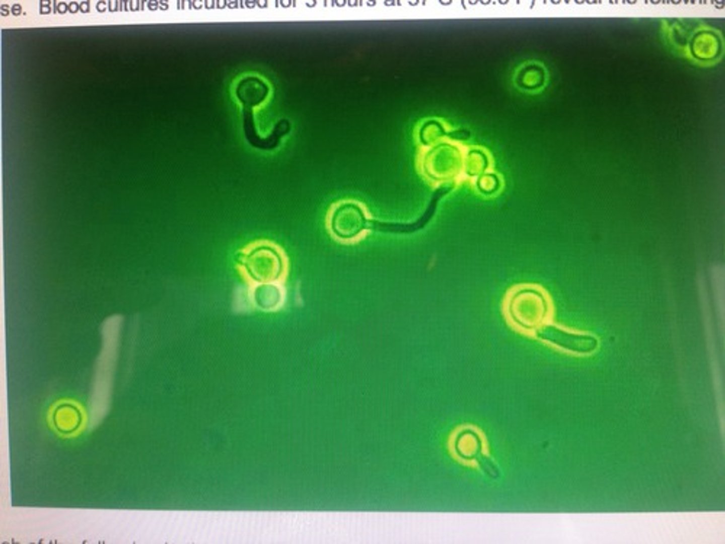 <p>ID the opportunistic mycoses</p>