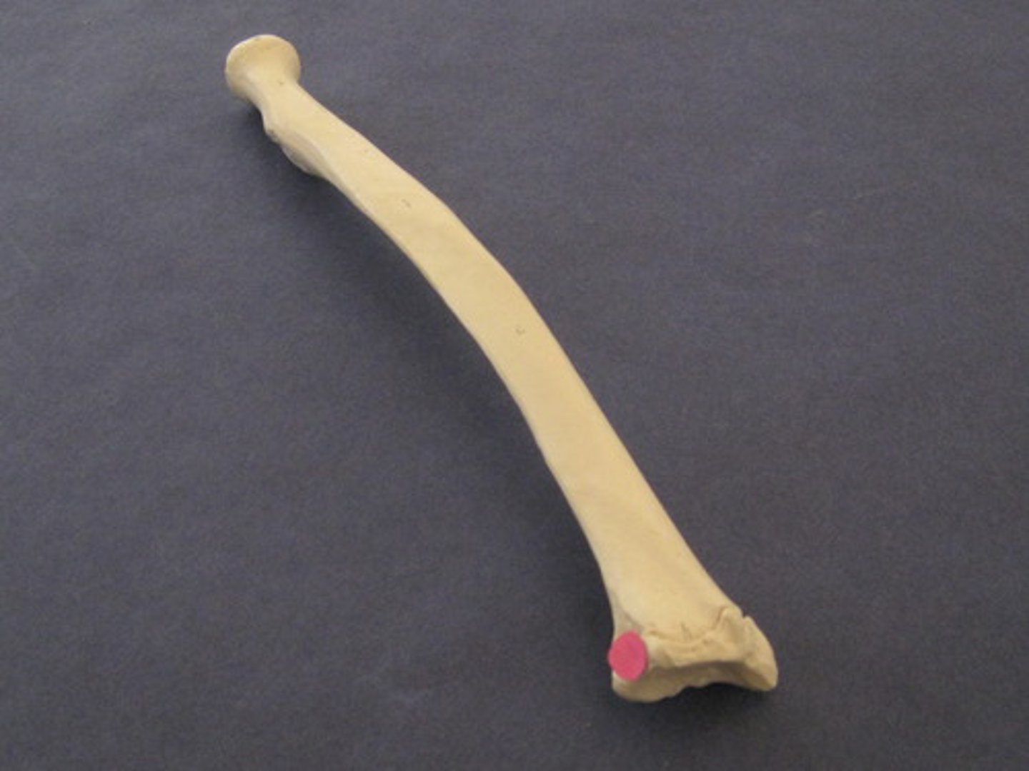 <p>bottom indent from ulna</p>
