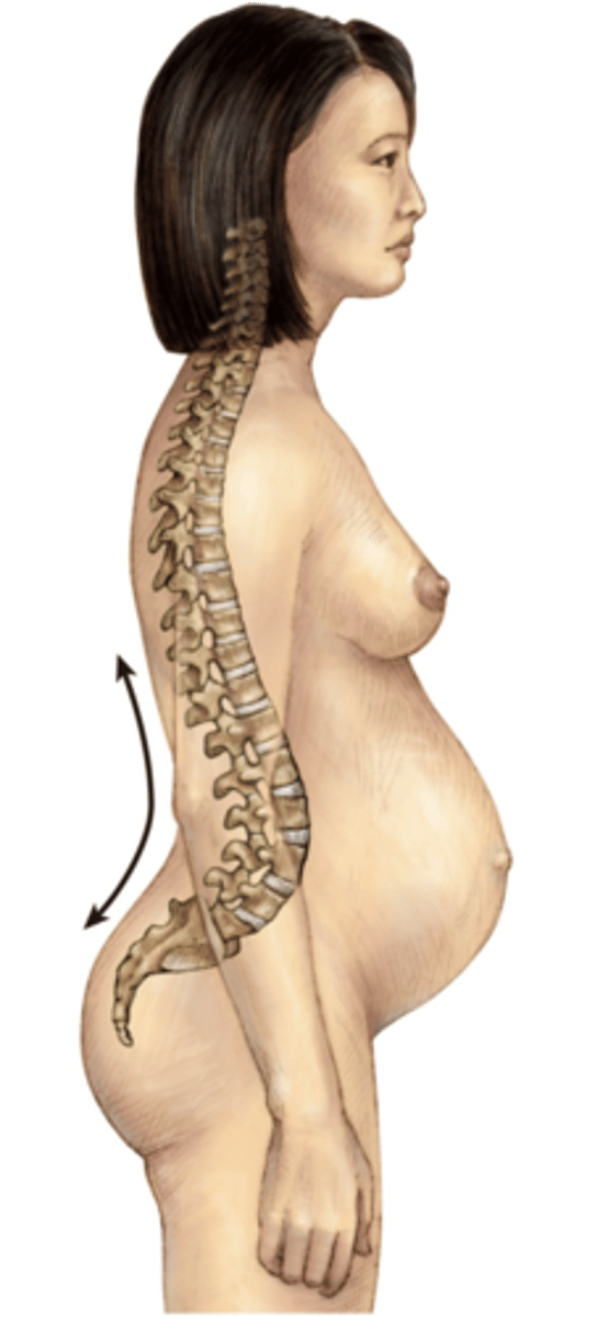 <p>The excessive curvature of the lumbar spine</p>