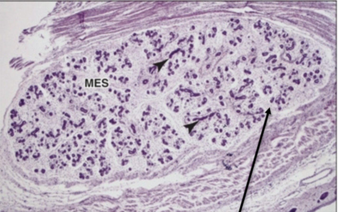<p>-composed of lobules within lobes</p>