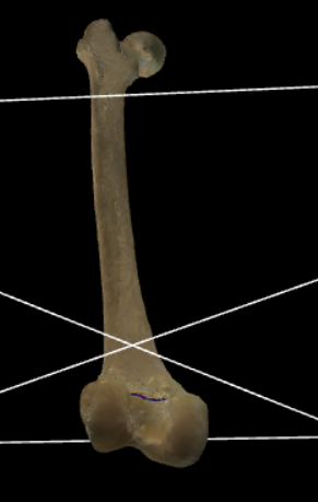 <p>Begrenst de fossa intercondylaris aan de craniale zijde.</p>