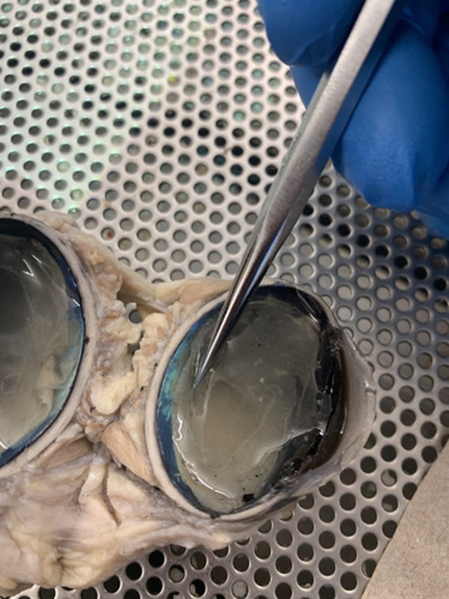 <p>the light-sensitive inner surface of the eye, containing the receptor rods and cones plus layers of neurons that begin the processing of visual information</p>