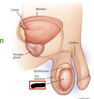 <p>What is this within the Scrotum?</p>