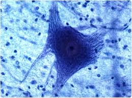 <p>Long neuronal process that conducts impulses away from the soma.</p>