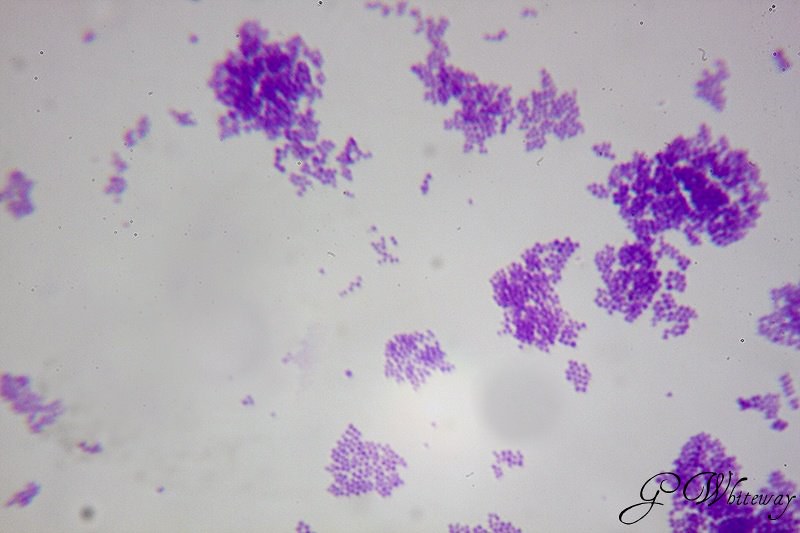 <p>Clusters of cocci</p><ul><li><p>“staphylo” = bunch of grapes</p></li></ul><p></p>