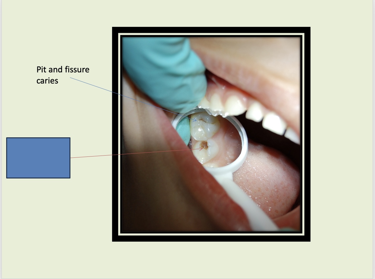 <p>What is indicated by the blue box?</p>