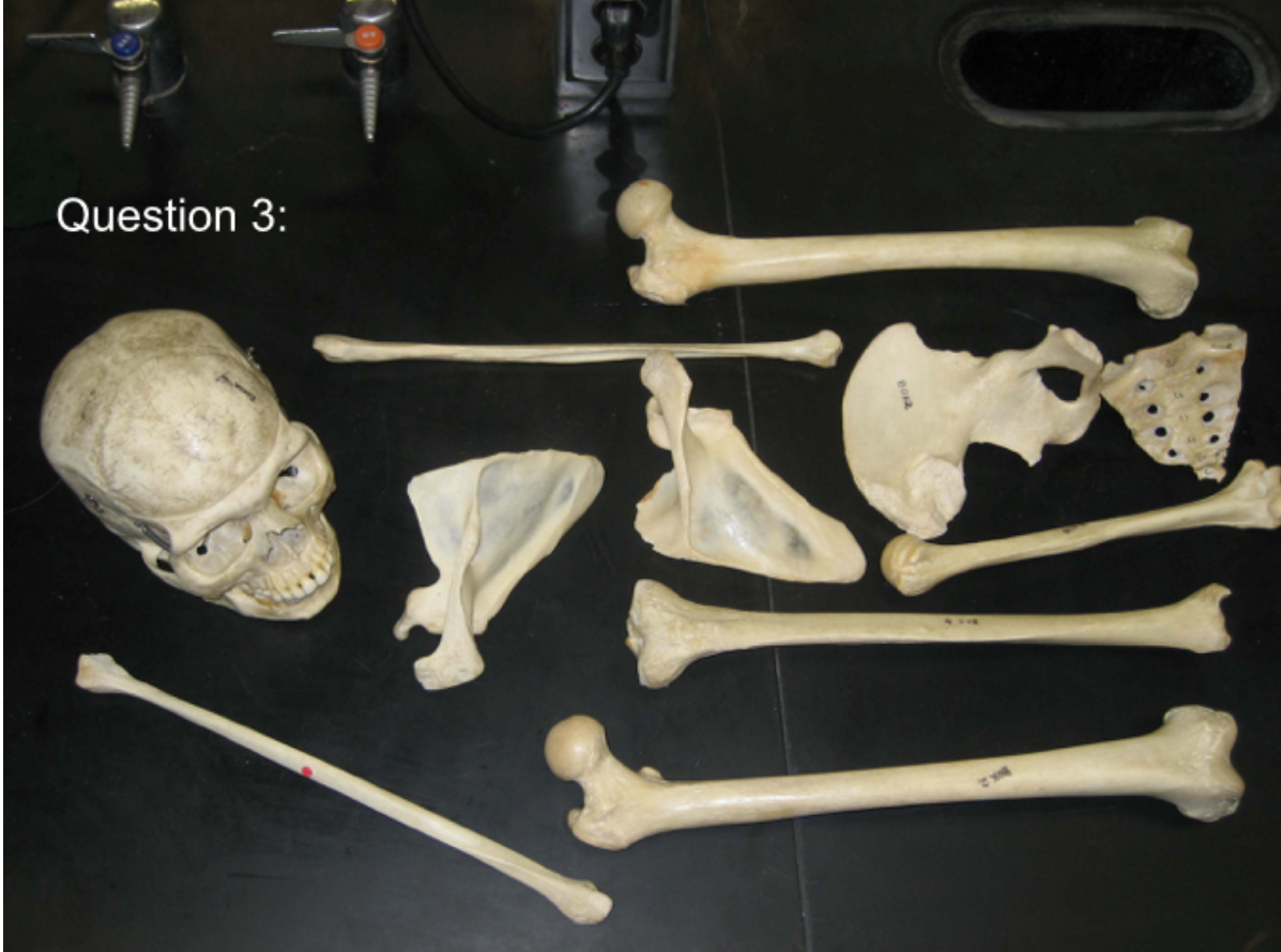 <p><span>How many individuals are present in this image?</span></p>