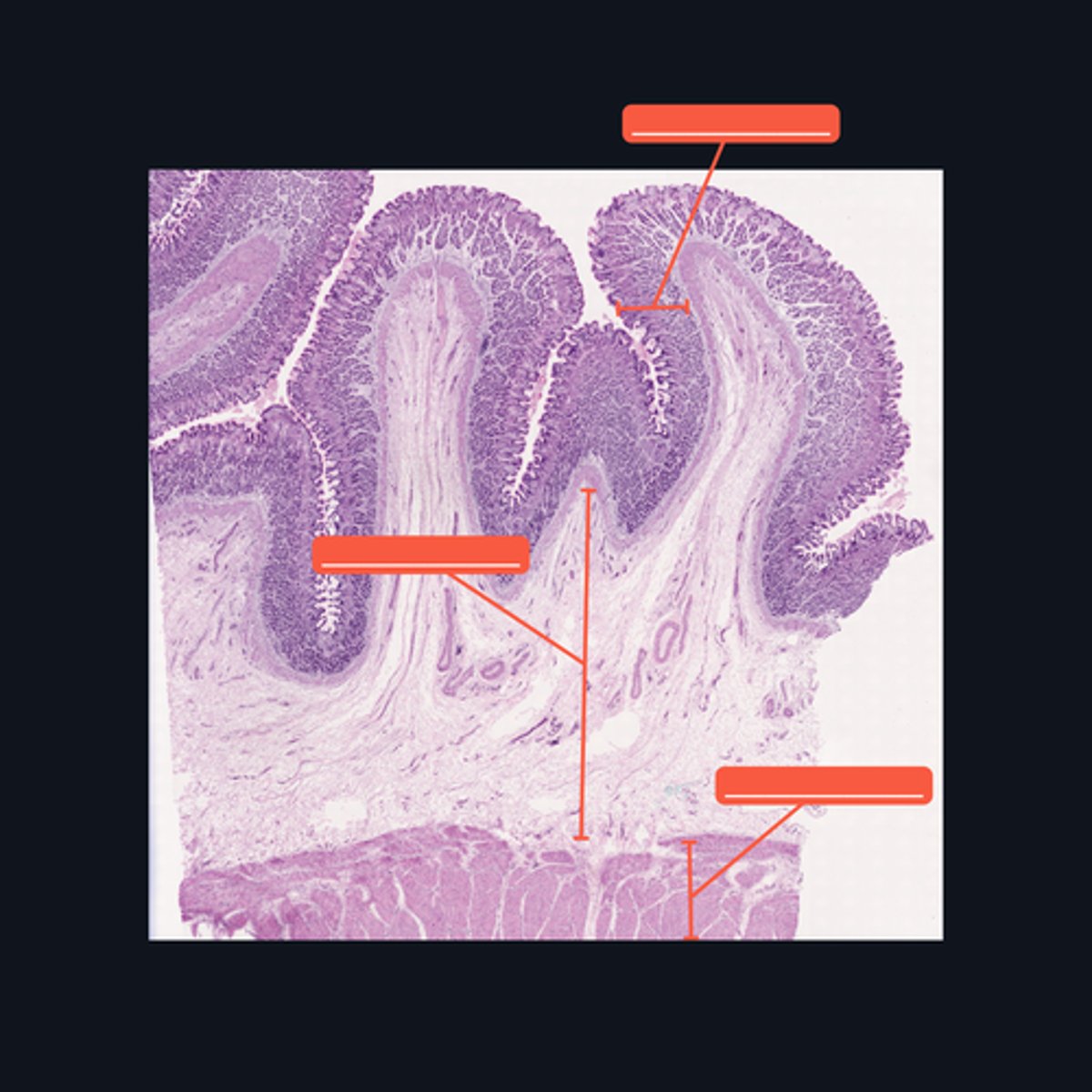 <p>Identify the histologic layers of the digestive tract</p>