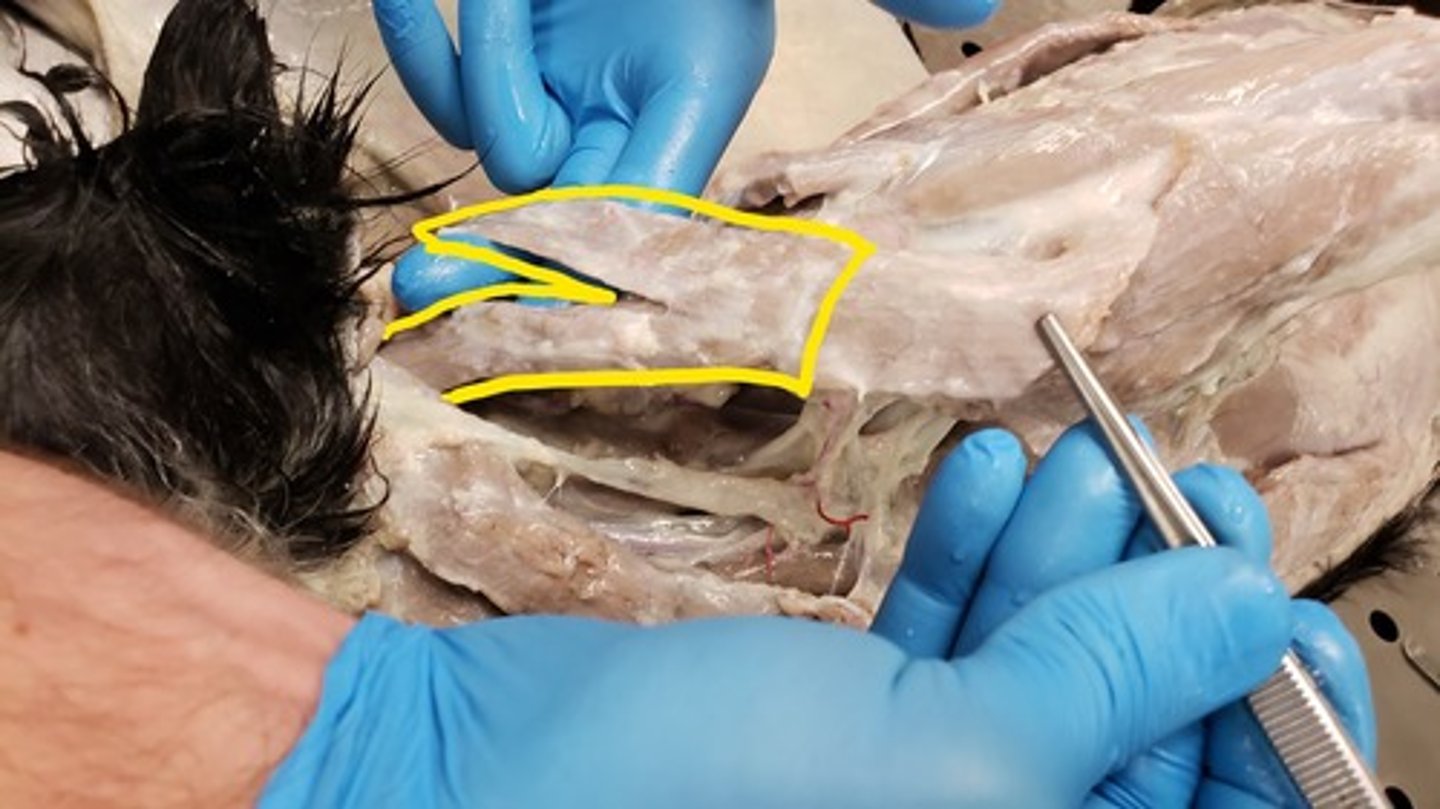 <p>What muscle is this?</p><p>Origin?</p><p>Insertion?</p><p>Function?</p><p>Innervation?</p><p>What larger muscle is this part of?</p>