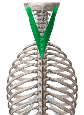 <p>What muscle is this?</p>