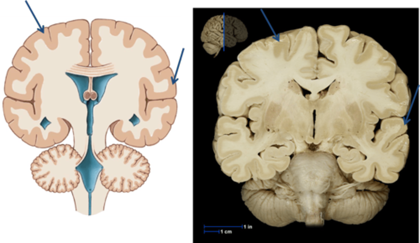 <p>outer region of the cerebrum, containing sheets of nerve cells; gray matter of the brain; the executive suite of the brain, where our conscious mind is found</p>
