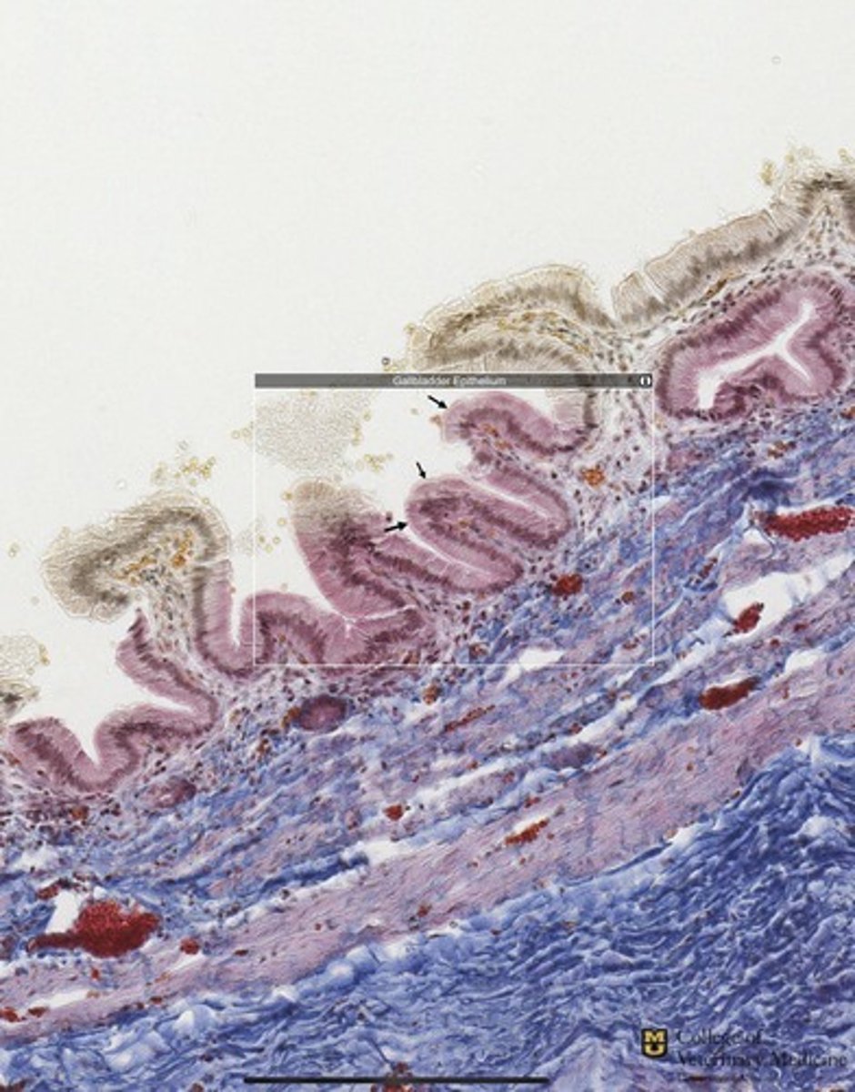 <p>What tissue type is shown?</p>