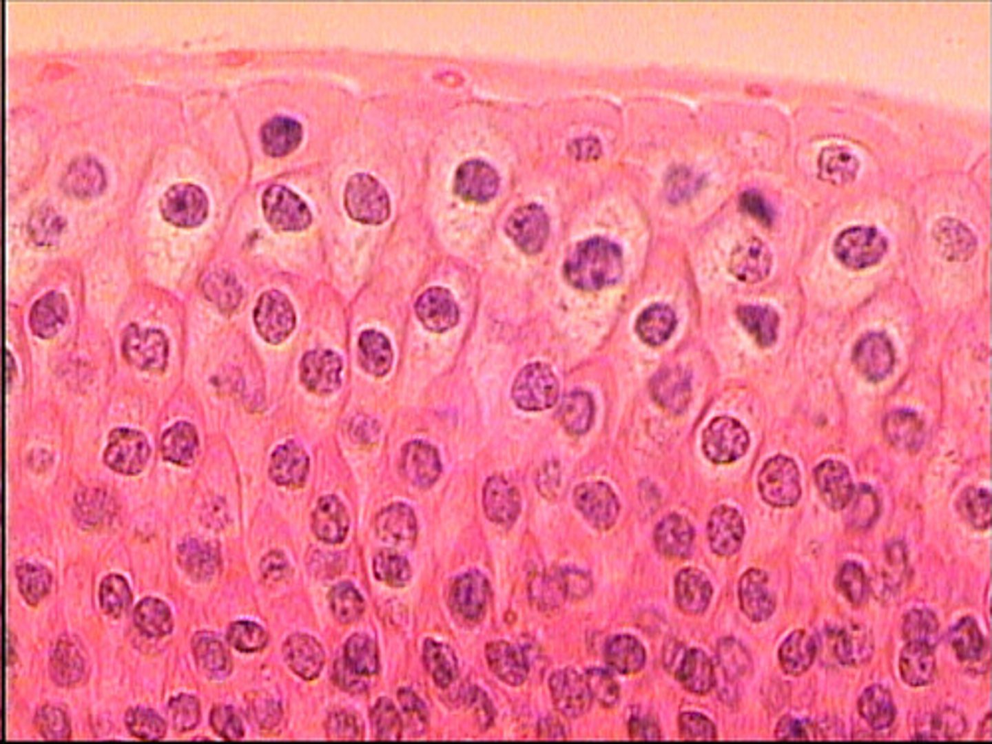 <p>combination of stratified squamous, cuboidal, and columnar cells (modified cuboidal cells)</p><p>lines urinary bladder</p><p>have ability to stretch</p>