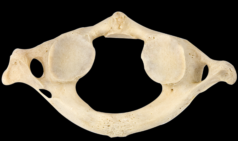 <p>Which bone is this?</p><p>(Inferior view).</p>
