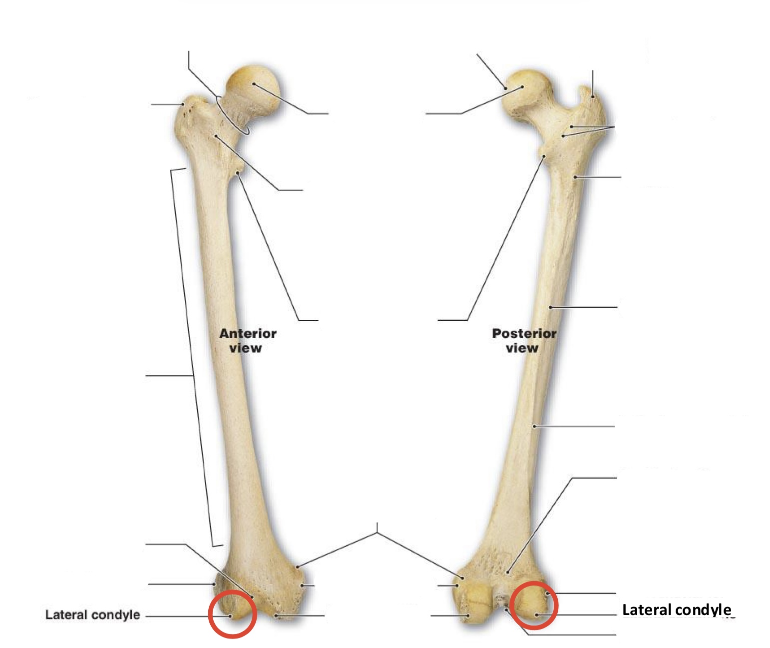 <p><span><span>Lateral condyle</span></span></p>
