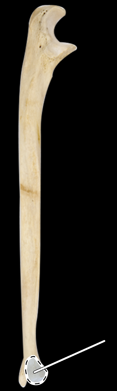 <p>Name the highlighted portion.</p><p>(Lateral view, right side).</p>