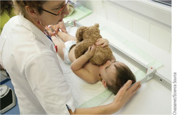 <p><span style="font-family: Arial">The length of toddlers &lt;2 years of age is measured in the recumbent position</span></p>