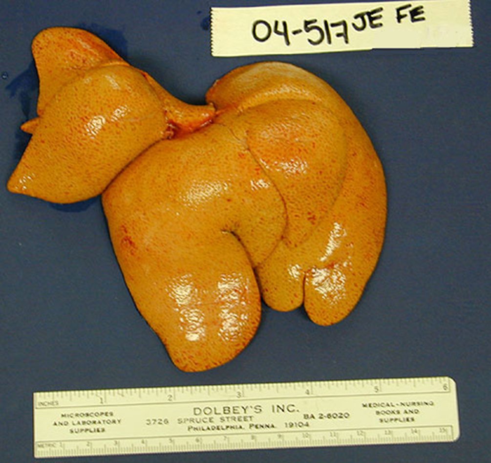 <p>What organ is this? Give a morphological description, morphological diagnosis, and possible cause</p>