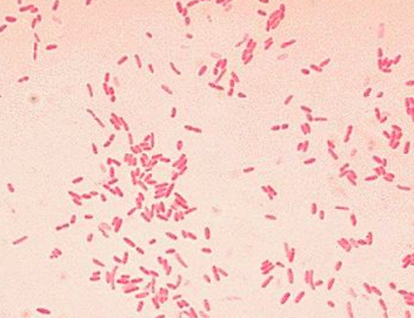 <p>Acinetobacter baumannii</p><p>Bordatella pertussis</p><p>Moraxella catarrhalis</p>