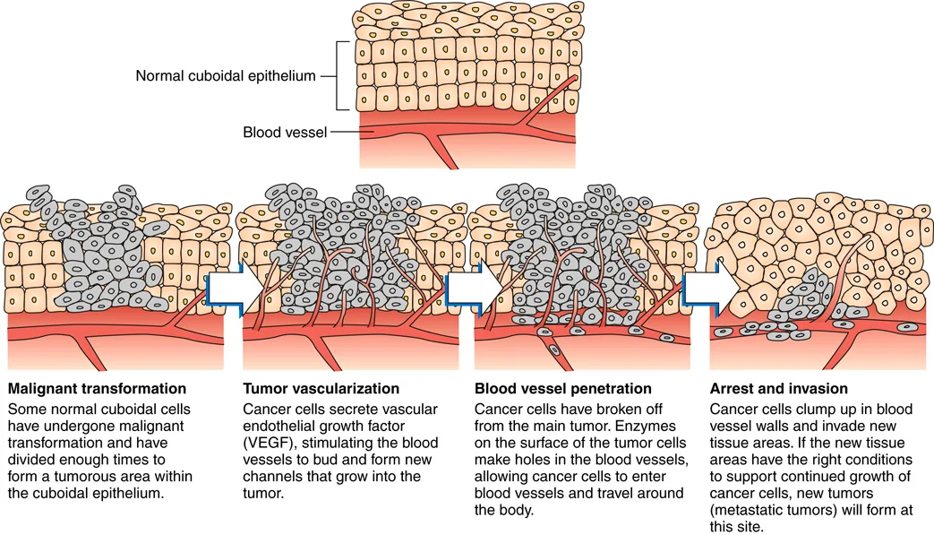 <p>transformation, vascularization, penetration, invasion</p>