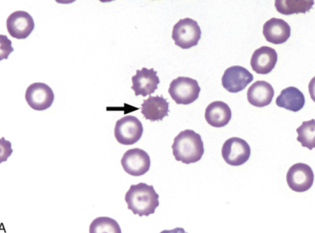 <p>what type of RBC abnormality is this</p>