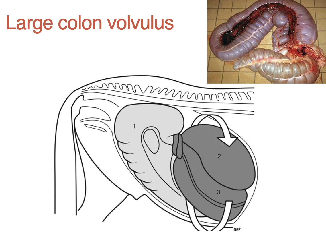<p>what is a large colon volvulus</p>