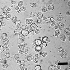 <p>Which fungi is this?</p>