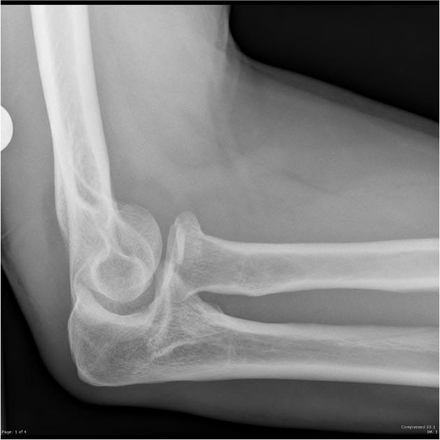 <p>Describe the abnormality demonstrated.</p>