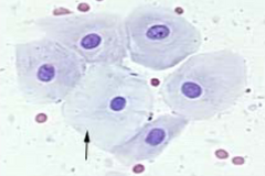 <p>Intermediate cells</p>