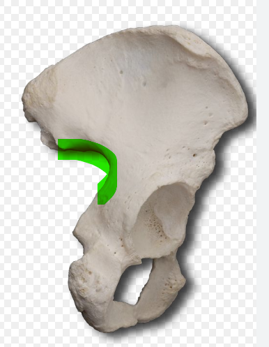 term image