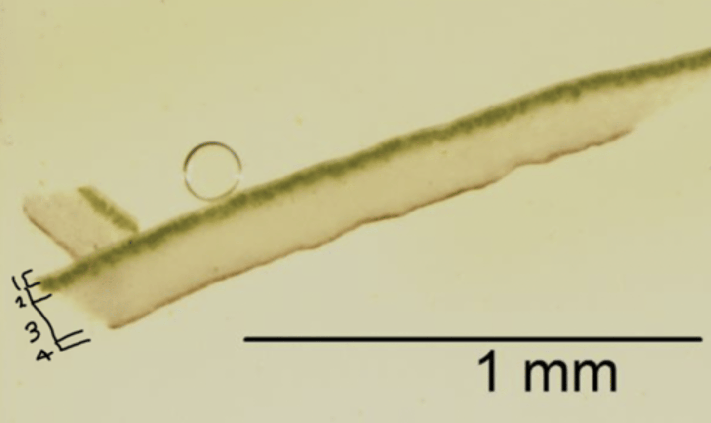 <p>has photosynthesizing green algae</p>