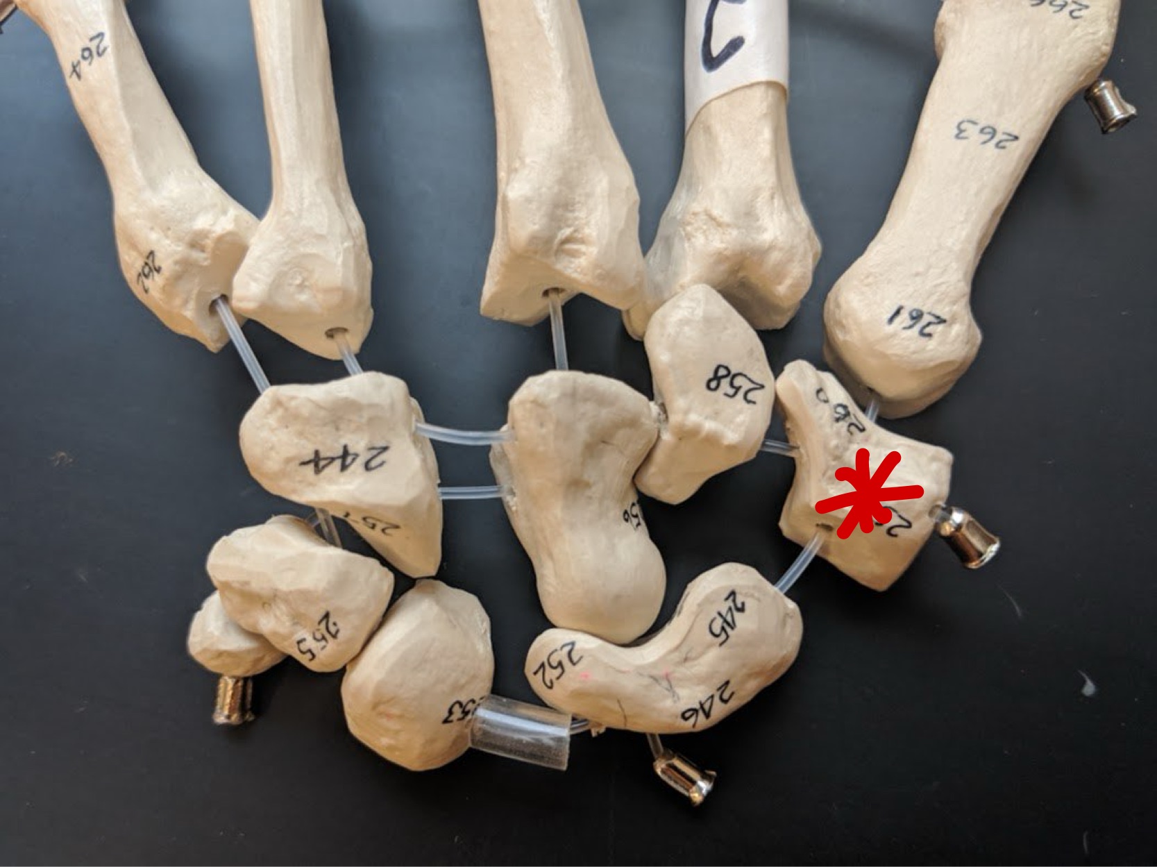 <p>Name this bone</p>