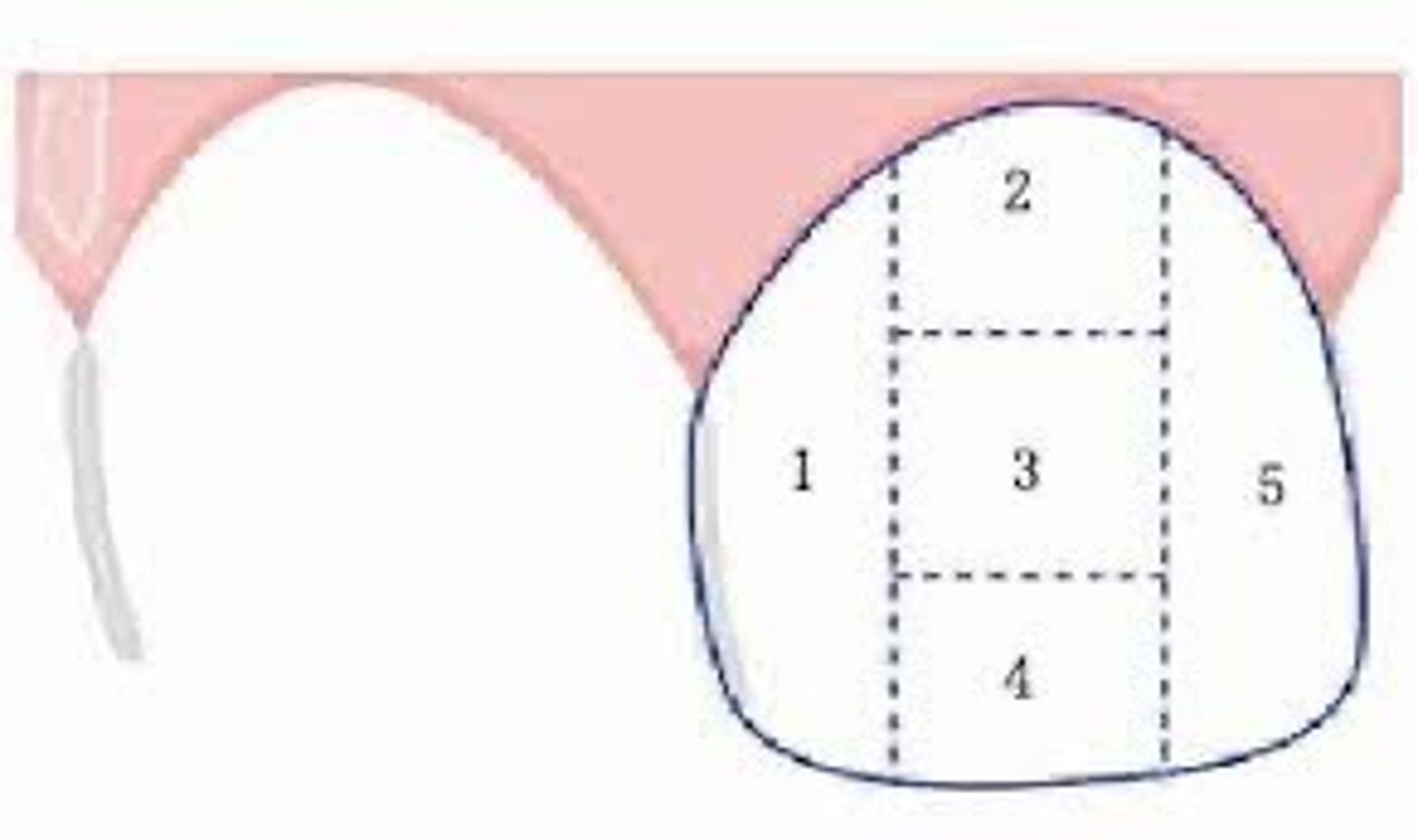<p>5 surfaces</p><p>-distal third</p><p>-mesial third</p><p>middle third divided into</p><p>--incisal third</p><p>--middle third</p><p>--gingival third</p>