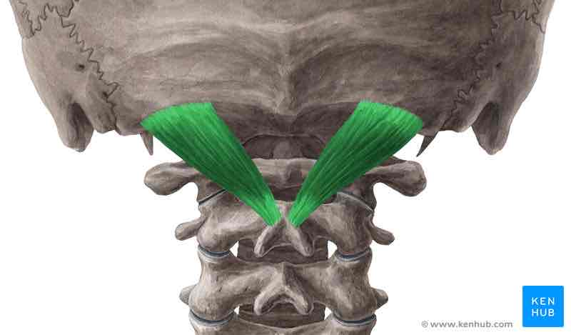 <p>Rectus capitis posterior major <strong>INSERTION</strong></p>