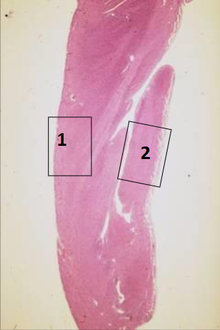 What is 2. 