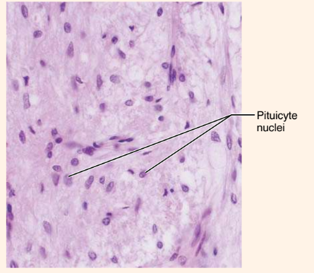<p>What endocrine organ or gland is this?</p>