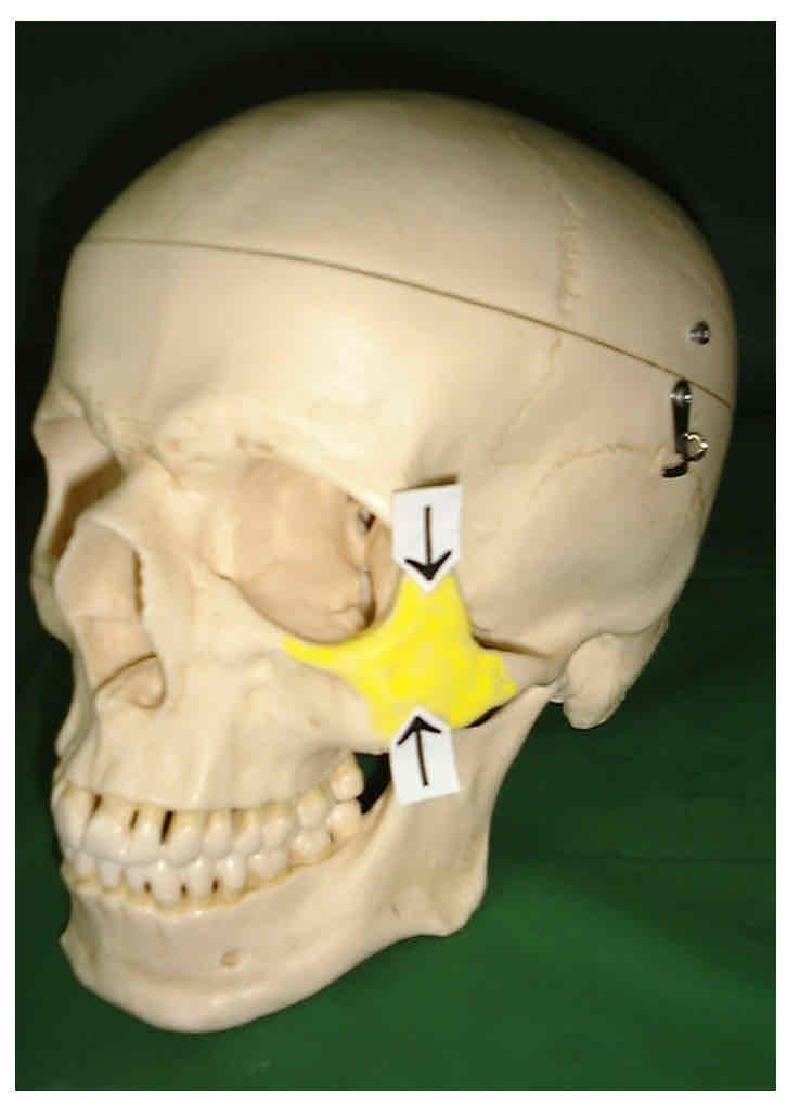 term image