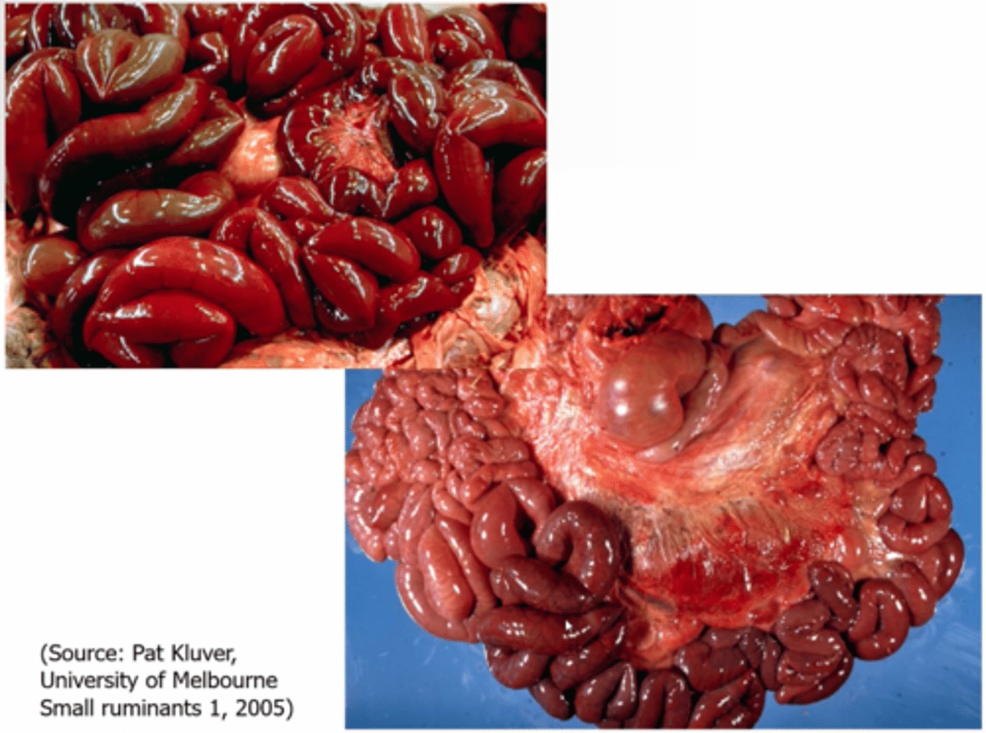 <p>- Carcass decomposes rapidly</p><p>- froth at the mouth</p><p>- large, single lambs</p><p>- Haemorrhages</p><p>- Pulpy kidneys</p><p>- Glycosuria</p>