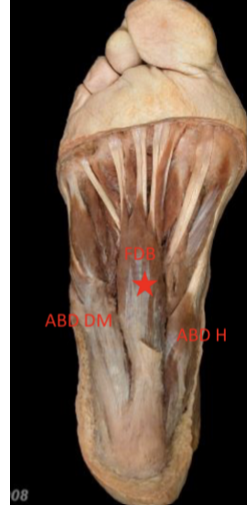 <p>flexor digitorum brevis </p>