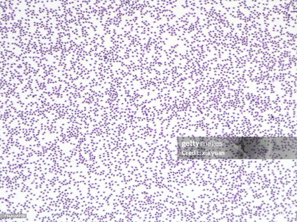 <p>What magnification level are the Red Blood Cells? </p>