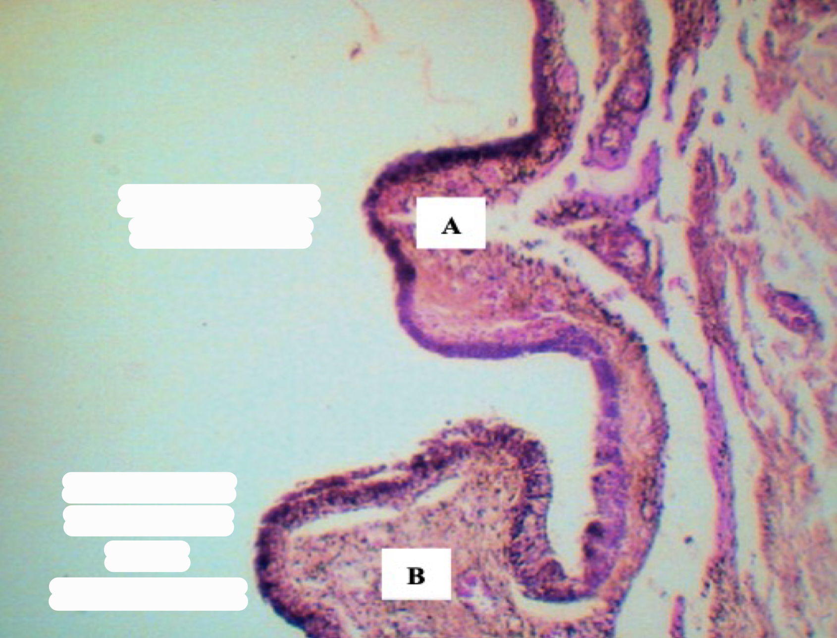 <p>Identify the structure</p>