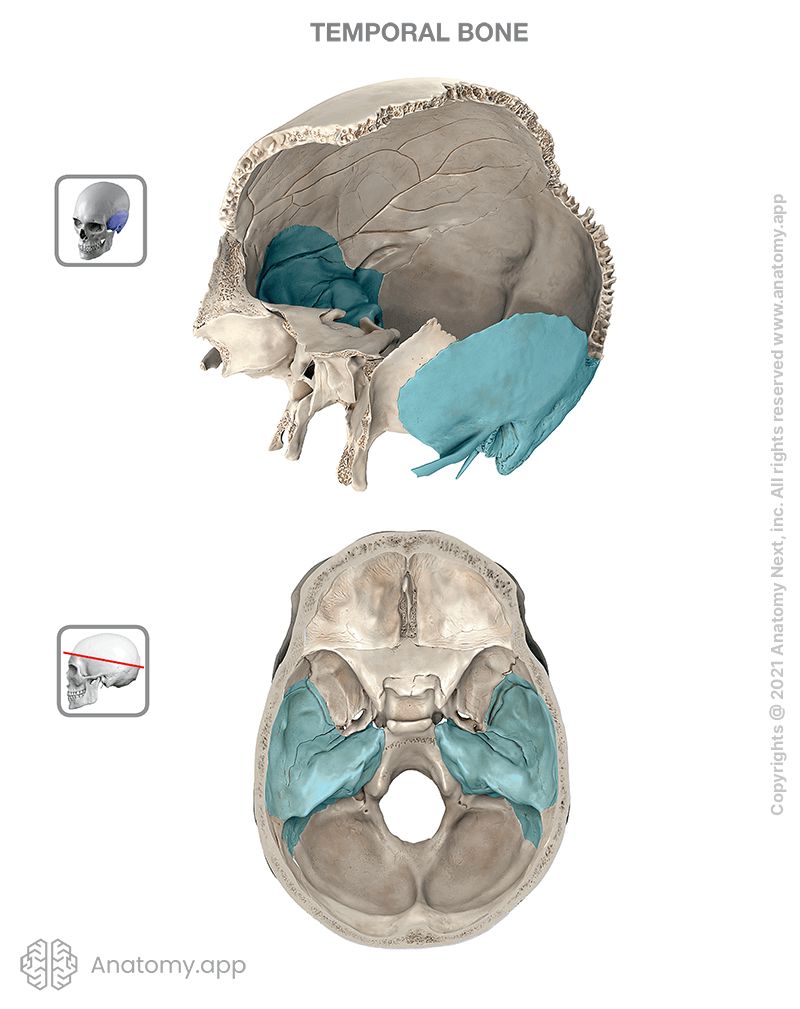 <p>A paired bone situated at the <strong>lateral side</strong> and <strong>base</strong> of the <strong>skull</strong>. (ie. <strong>ears</strong>)</p><ul><li><p><strong>Mastoid Process </strong>- An <strong>extension</strong> of the<strong> </strong>temporal bone located <strong>behind</strong> the <strong>ear</strong>, just posterior to the external acoustic opening. Many muscles of the <strong>neck</strong> <strong>attach to this process</strong>.</p></li><li><p><strong>External Auditory Meatus </strong>- The <strong>outside</strong> opening to the <strong>ear</strong>.</p></li><li><p><strong>Styloid Process</strong> - A slender <strong>sharp</strong> <strong>projection</strong> of the temporal <strong>bone</strong>.</p></li></ul><p></p>