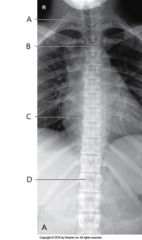 <p><span>What does letter D represent?</span></p>